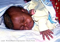 La malaria una de las principales causas de muerte en niños menores a cinco años en África