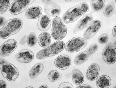 Bacteria de la brucelosis
