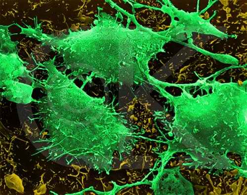 Fotograf�a de microscopio electr�nico de una c�lula de c�ncer cerebral.