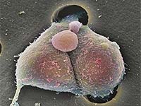 Células de cáncer de prostata.