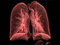 Tejido pulmonar visto en 3D
