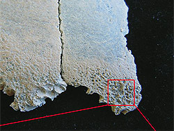 Lesiones interpretadas como anemia en el parietal del niÃ±o de Olduvai
