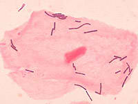 Lactobacillus plantarum 299