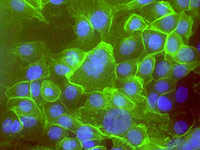 Células madre de cáncer. Foto: Tan Ince