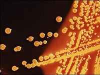 Colonias de la bacteria Escherichia coli creciendo en una placa de cultivo. Foto: CDC